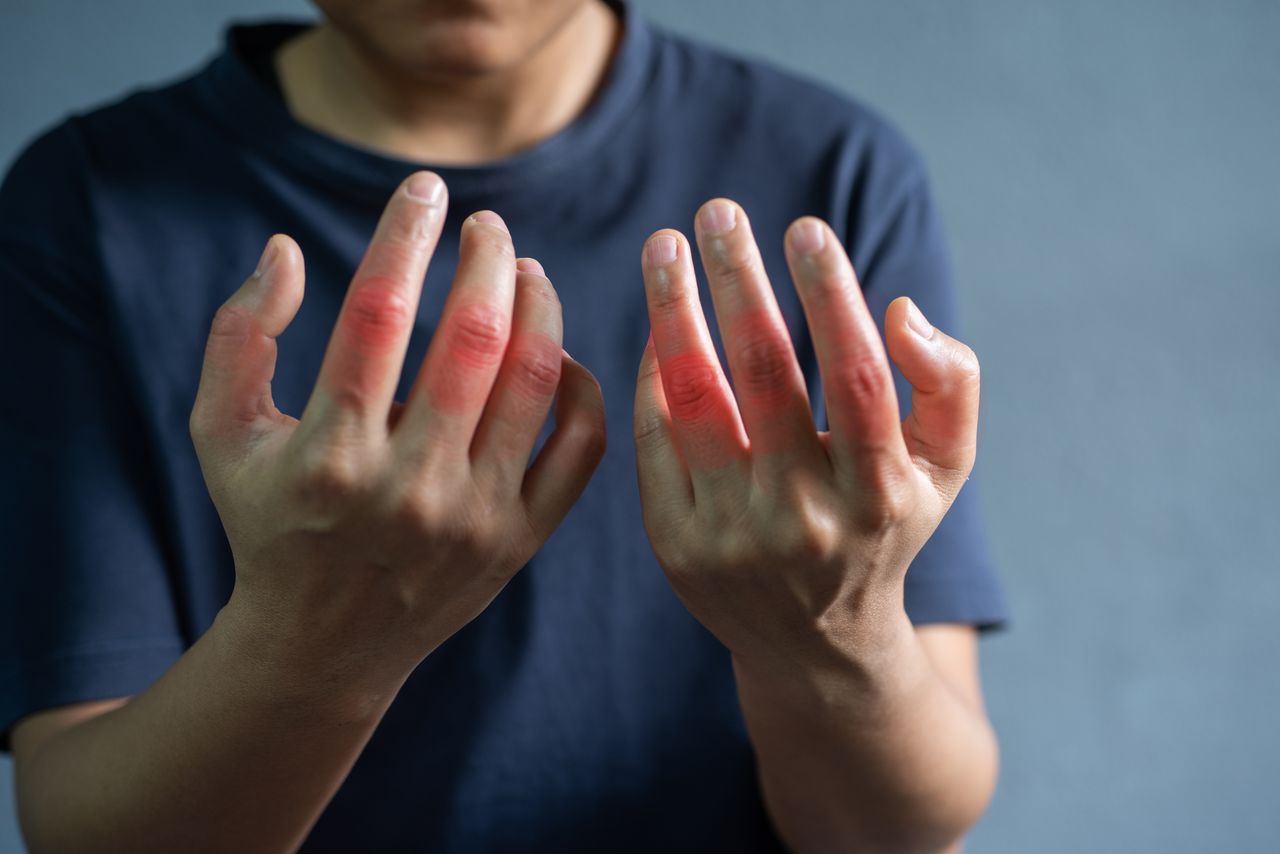 13 Things To Know About Living With Rheumatoid Arthritis